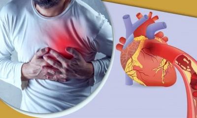 হার্টের রিংয়ের দাম বেঁধে দিল সরকার