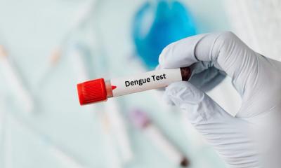 Dengue test fixed for Tk 50 at govt hospitals