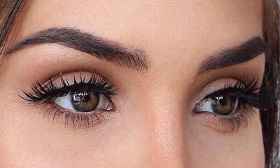 চোখের স্ট্রোক কেন হয়?