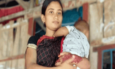 ভুল অস্ত্রোপচারে প্রসূতির মৃত্যুর অভিযোগ