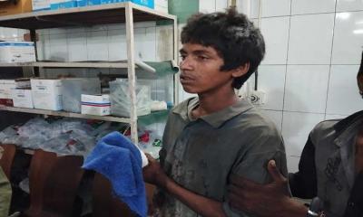 Teen injured in Nayapaltan explosion from crude bomb