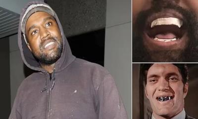 সোনা, হিরা, টাইটেনিয়াম দিয়ে বউকে নয়, তিনি সাজান দাঁত