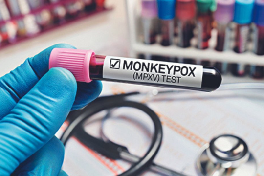 India orders health screening at ports, airports to minimise risk of monkeypox