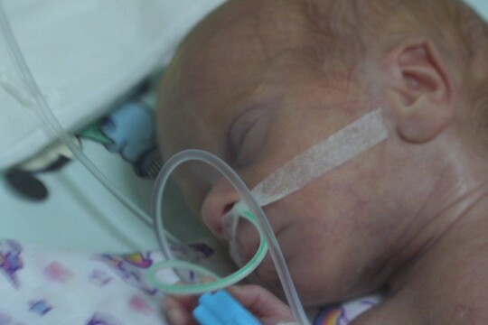 Premature babies struggling for life in Ukraine