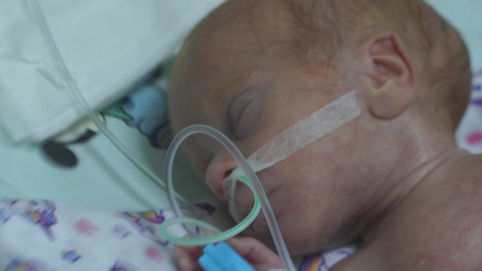 Premature babies struggling for life in Ukraine