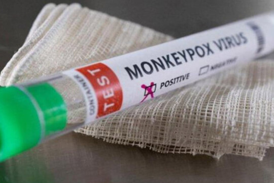 Los Angeles confirmed first monkeypox death