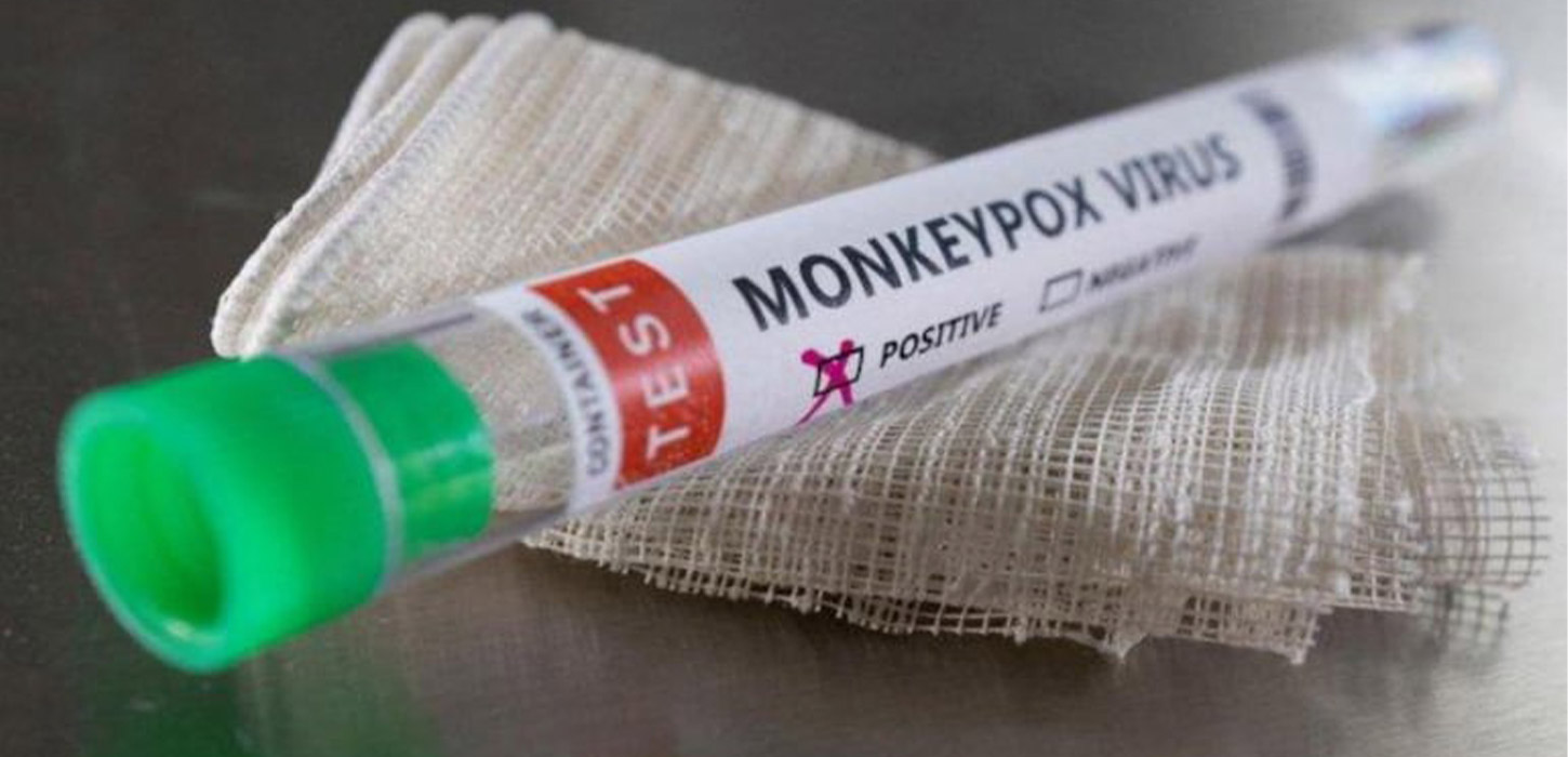 Los Angeles confirmed first monkeypox death