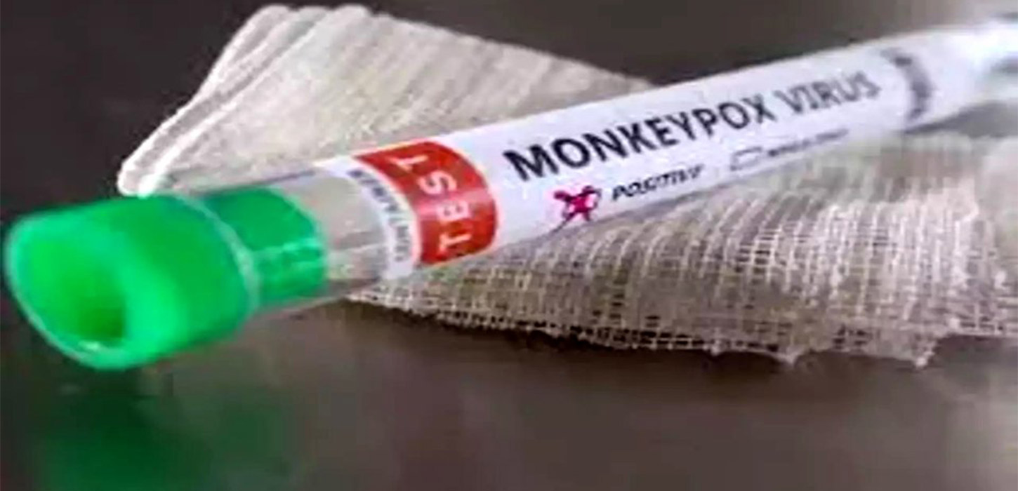 Peru registers first death in monkeypox patient: hospital