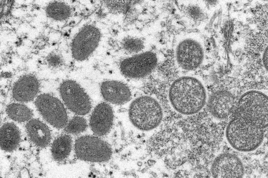 US state San Francisco declares emergency over monkeypox spread