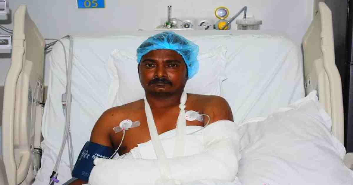 Rare surgery in Khulna saves Indian worker's wrist