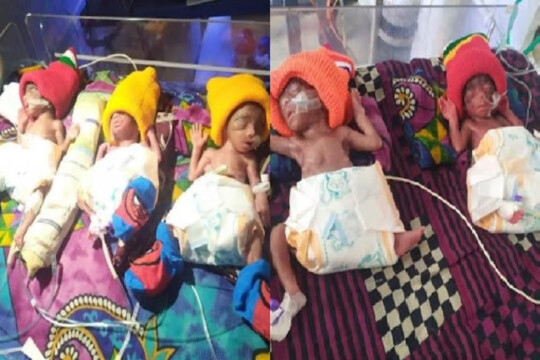 Woman in Kushtia gives birth to five at once without operation