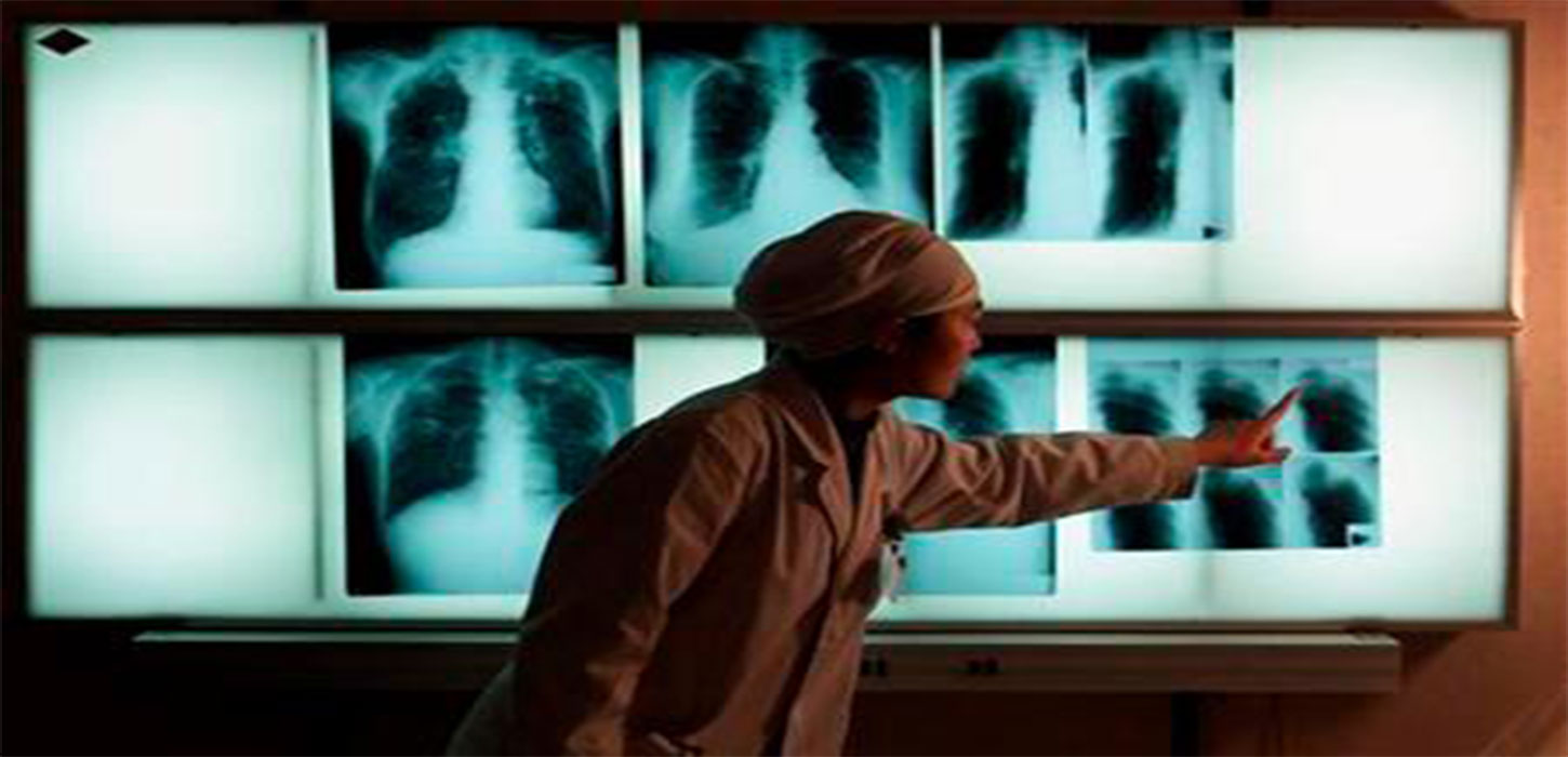 Urgency lacking as TB passes Covid as biggest killer